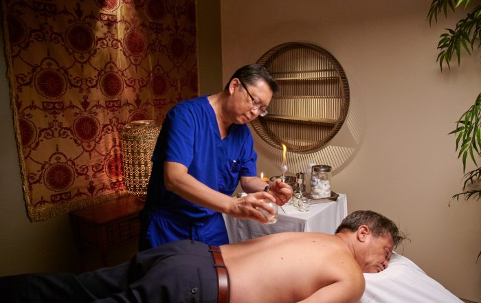 Acupuncturist performing cupping procedure