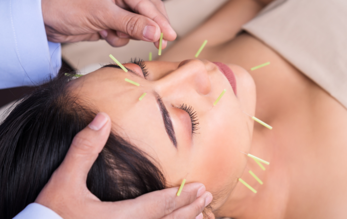 How to become an acupuncturist