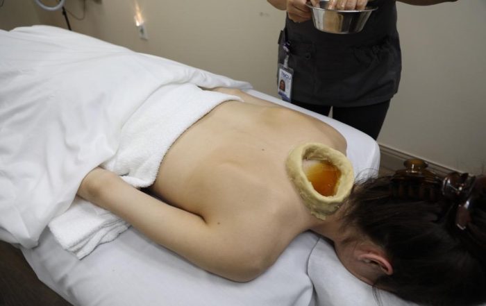 A photo of an unidentifiable patient receiving a Greeva Basti (neck therapy) Ayurveda treatment at SCU Health.