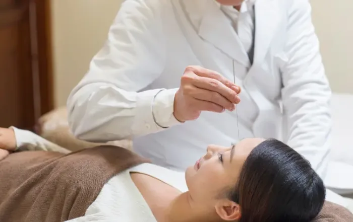 Acupuncture in action