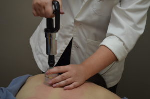 Dr. Jamie Kuljis performs a cupping treatment on a patient.