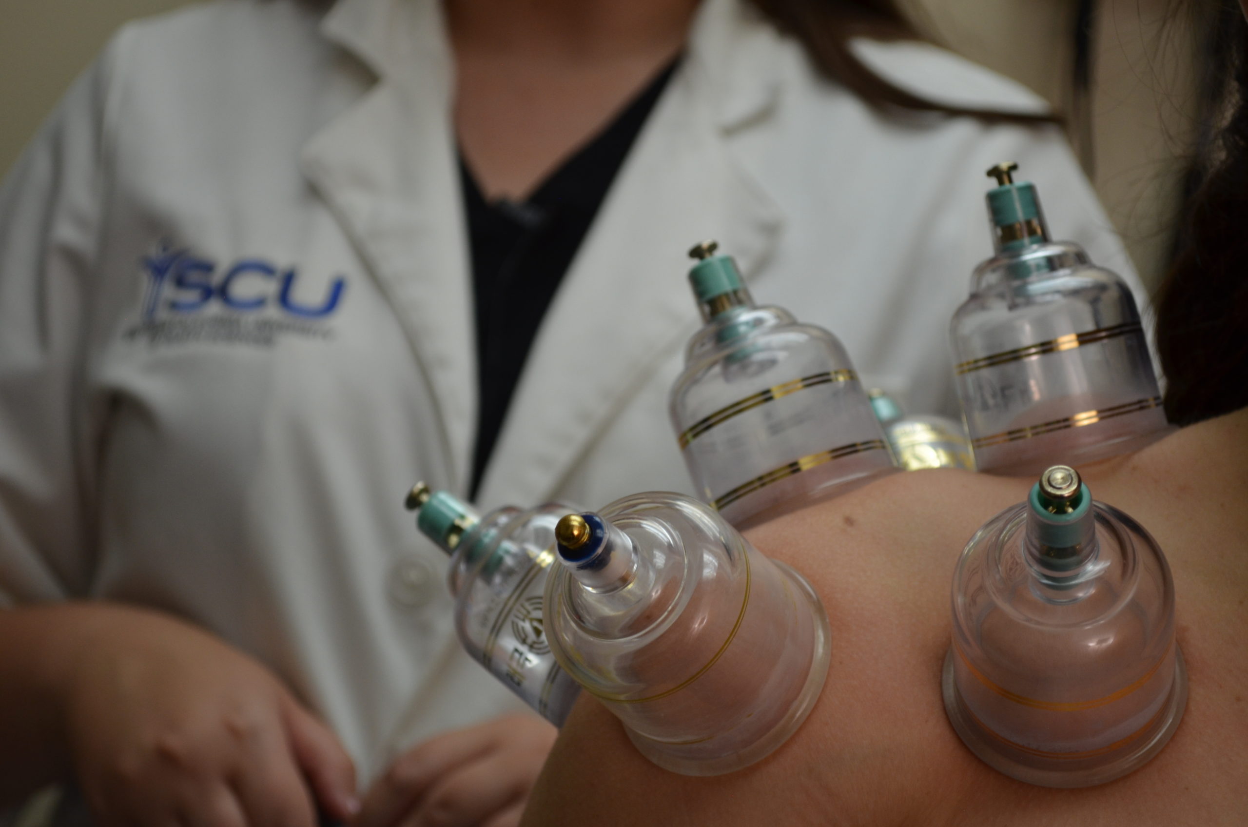 Dr. Jamie Kuljis performs a cupping treatment on a patient.