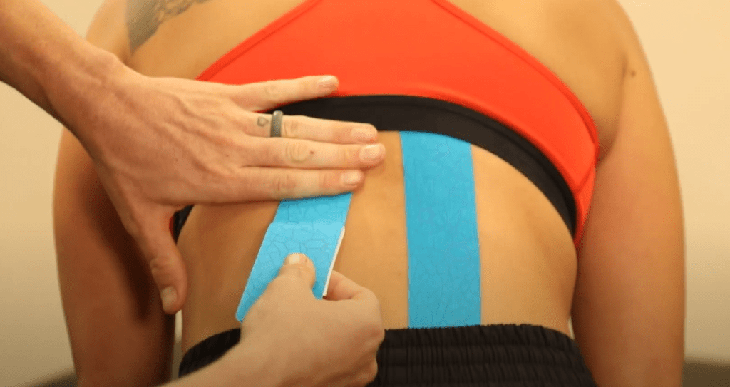 How Chiropractic Students Use Kinesio Tape to Treat Knee Pain and More - SCU