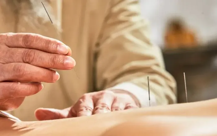 Master's or Doctorate? Choosing Your Acupuncture Path in Southern California