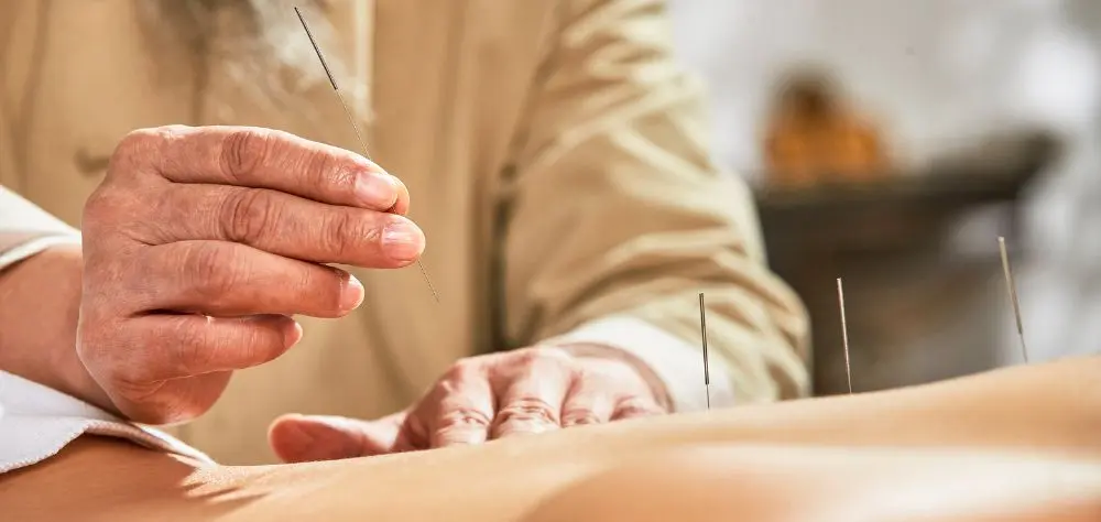 Master's or Doctorate? Choosing Your Acupuncture Path in Southern California