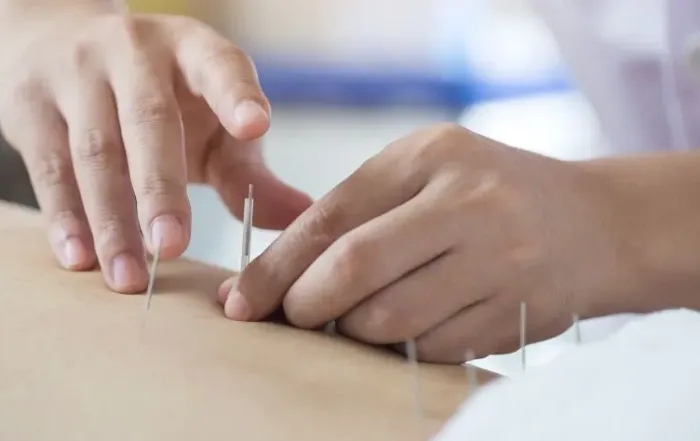 Master's vs. Doctorate in Acupuncture—Which Path Is Right?