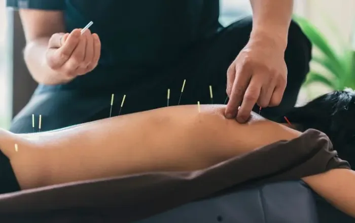 acupuncture-education