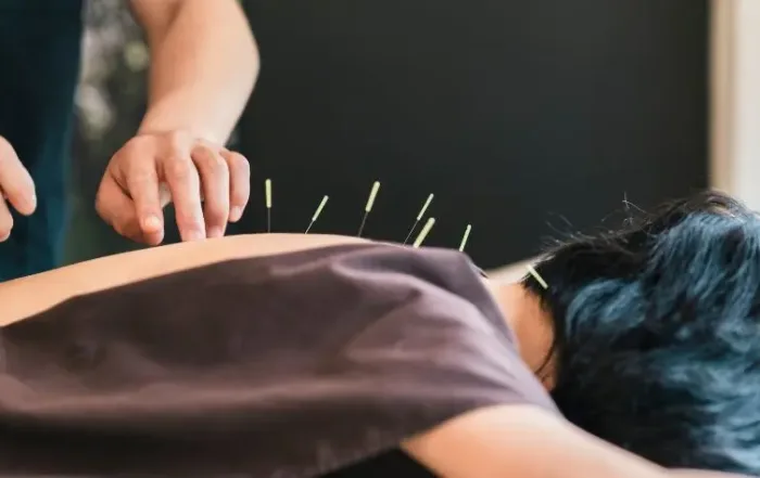 hybrid-acupuncture-program