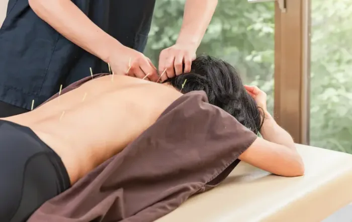 online-acupuncture-school