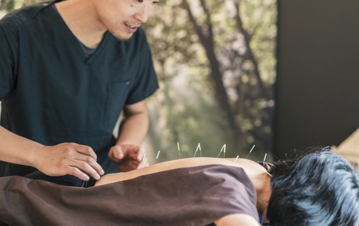 Therapist Giving Cupping Treatment To Young Asian Woman