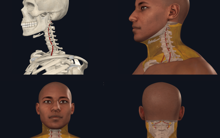A screenshot image capture from 3D4Medical's Complete Anatomy in SCU's Anatomy Lab illustrates where the vertebral artery is located within the bones of the neck (cervical spine).