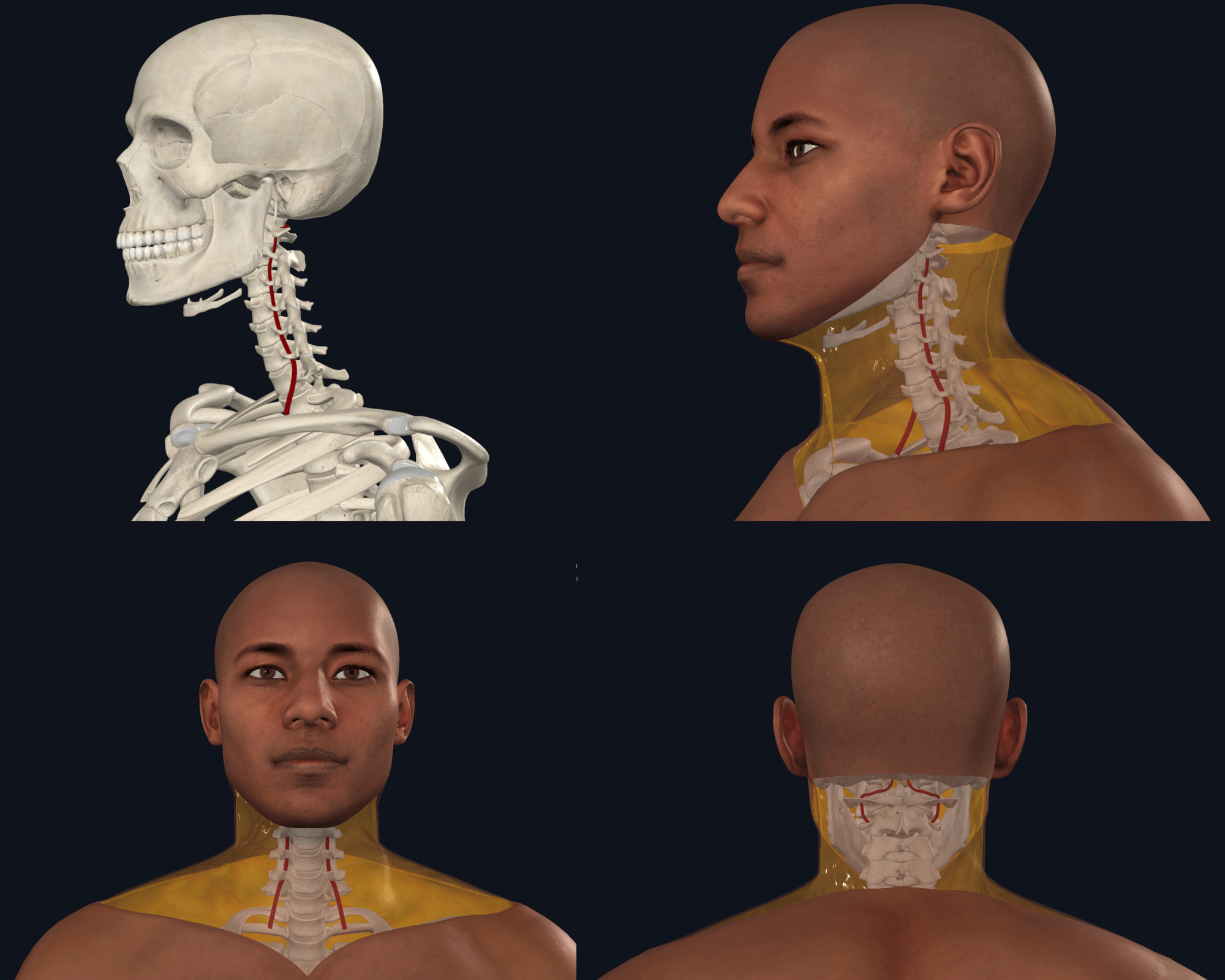 A screenshot image capture from 3D4Medical’s Complete Anatomy in SCU’s Anatomy Lab illustrates where the vertebral artery is located within the bones of the neck (cervical spine).